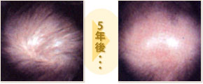 5年後・・・