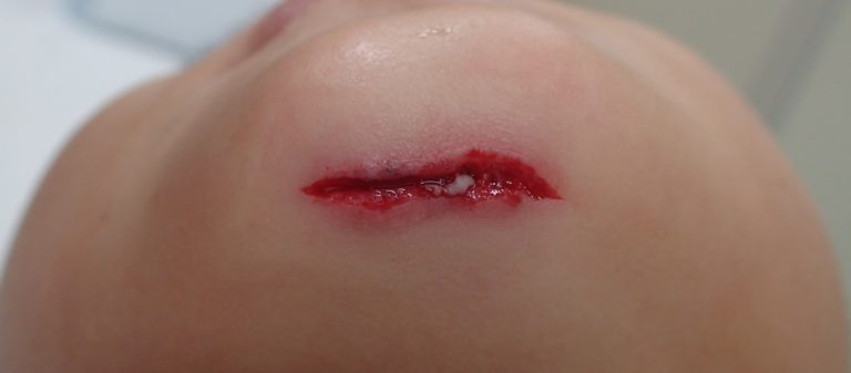 初診時