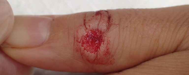 初診時