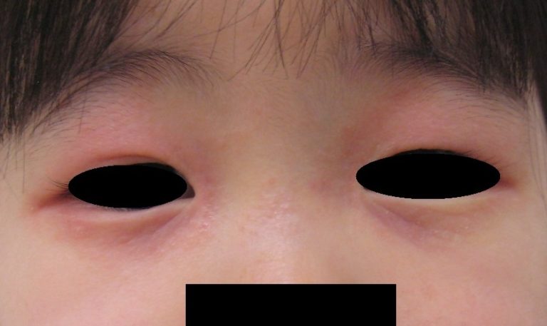 初診時2