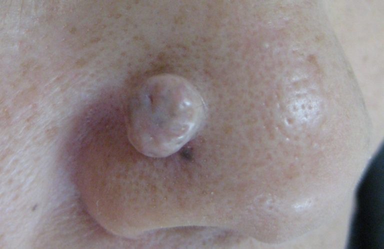 術前2